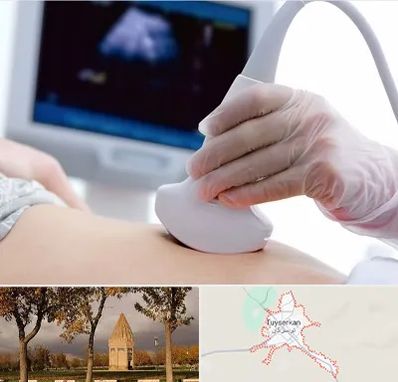 سونوگرافی در تویسرکان
