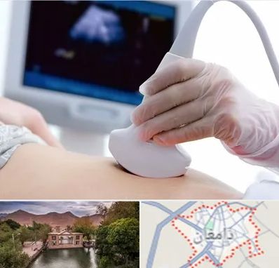 سونوگرافی در دامغان
