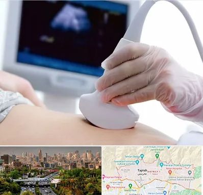 سونوگرافی در منطقه 1 تهران