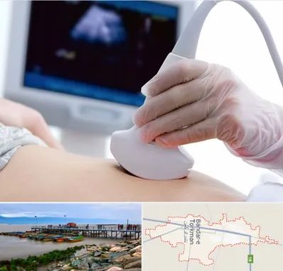 سونوگرافی در بندر ترکمن