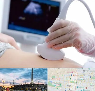 سونوگرافی در منطقه 2 تهران