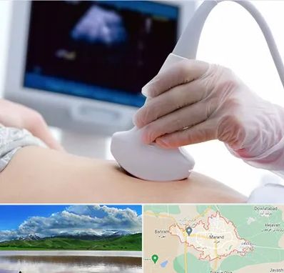 سونوگرافی در مرند