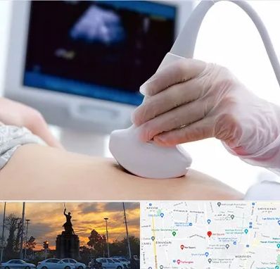 سونوگرافی در میدان حر