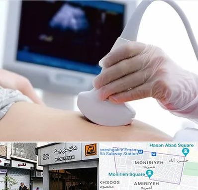 سونوگرافی در منیریه