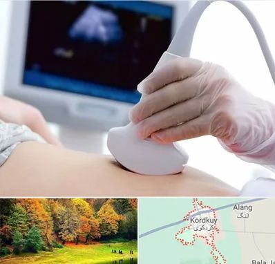 سونوگرافی در کردکوی