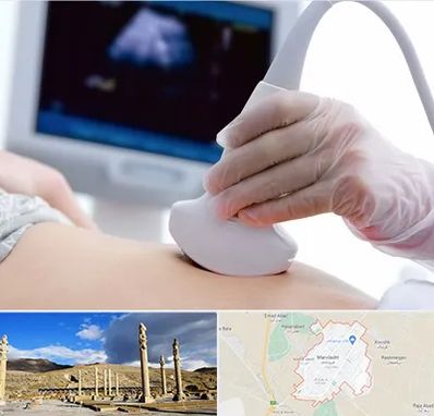 سونوگرافی در مرودشت