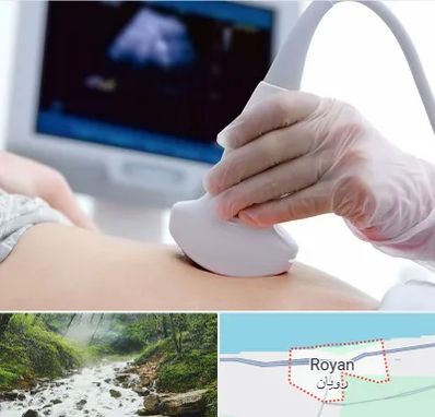 سونوگرافی در رویان