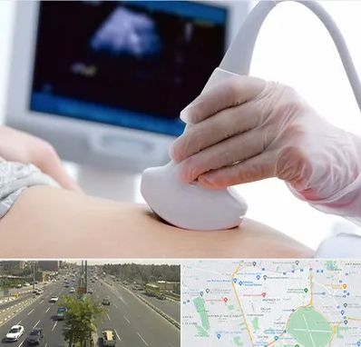 سونوگرافی در منطقه 17 تهران