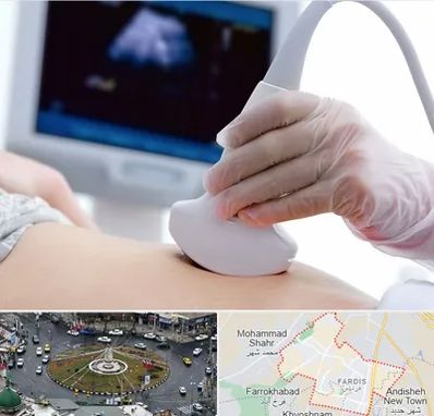 سونوگرافی در فردیس کرج