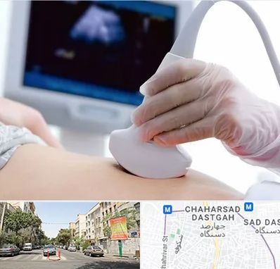 سونوگرافی در چهارصد دستگاه