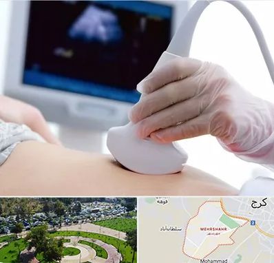 سونوگرافی در مهرشهر کرج