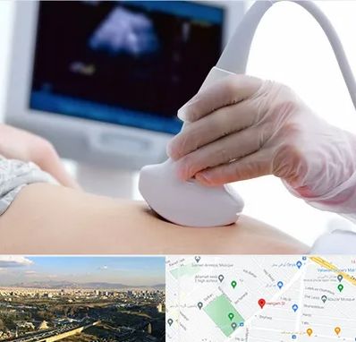 سونوگرافی در هنگام