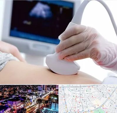 سونوگرافی در منظریه رشت