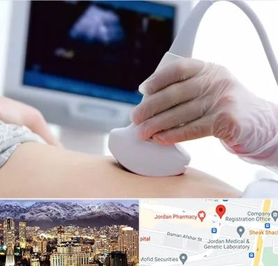 سونوگرافی در جردن