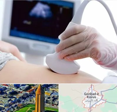 سونوگرافی در گنبد کاووس