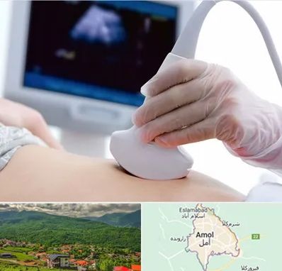 سونوگرافی در آمل