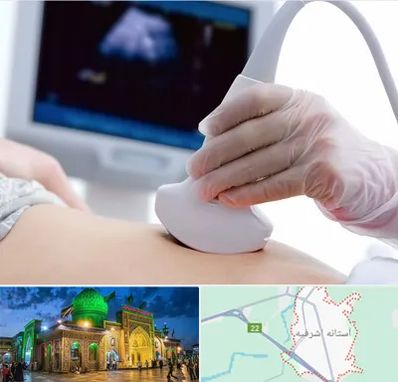 سونوگرافی در آستانه اشرفیه