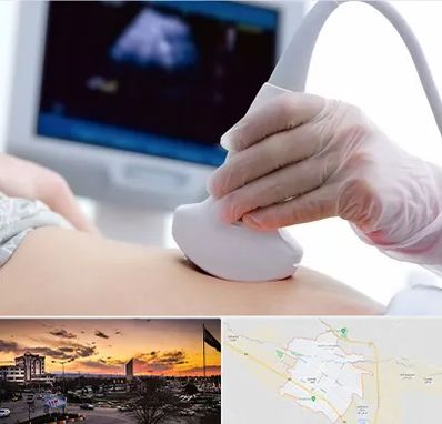 سونوگرافی در قوچان