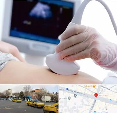 سونوگرافی در شهناز تبریز