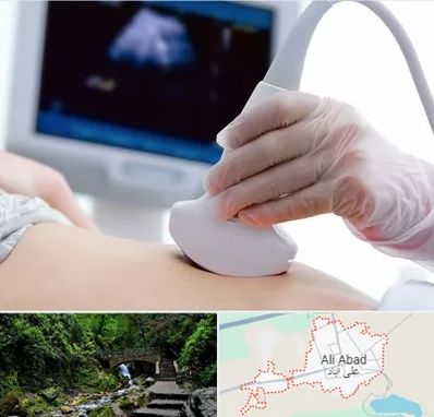 سونوگرافی در علی آباد کتول
