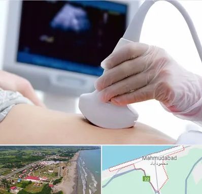 سونوگرافی در محمودآباد