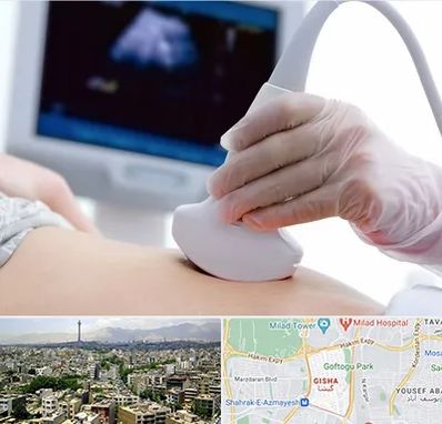 سونوگرافی در گیشا