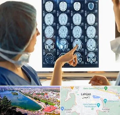 رادیولوژی در لاهیجان