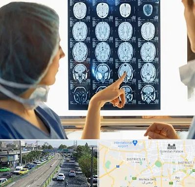 رادیولوژی در جنوب تهران 