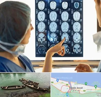 رادیولوژی در بندر انزلی