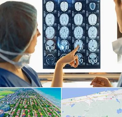 رادیولوژی در فریدونکنار