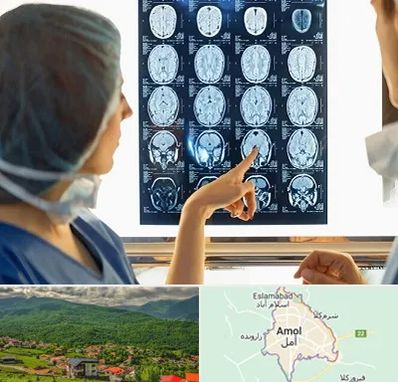 رادیولوژی در آمل