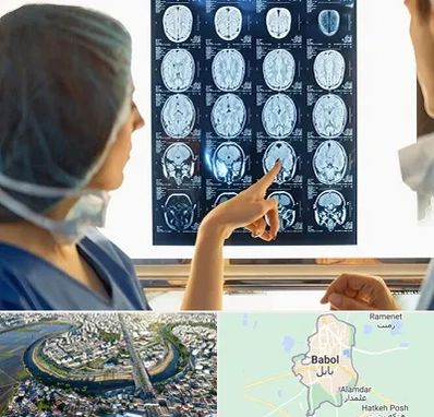 رادیولوژی در بابل