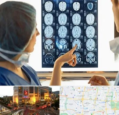 رادیولوژی در جنت آباد تهران 