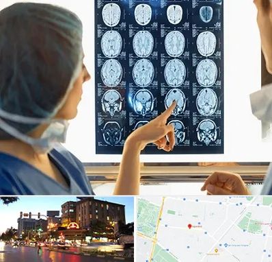 رادیولوژی در بلوار سجاد مشهد