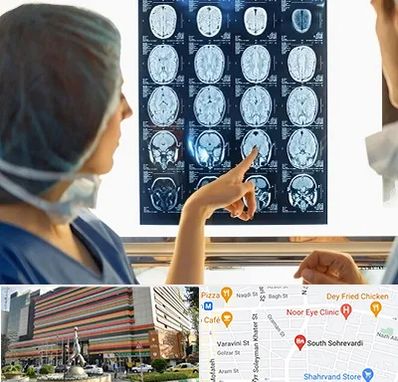 رادیولوژی در سهروردی 