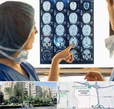 رادیولوژی در آپادانا