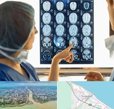 رادیولوژی در تنکابن