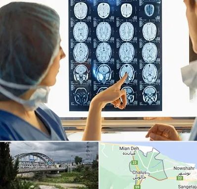 رادیولوژی در چالوس