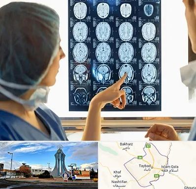 رادیولوژی در تایباد