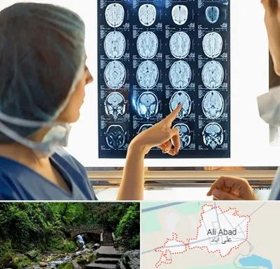 رادیولوژی در علی آباد کتول
