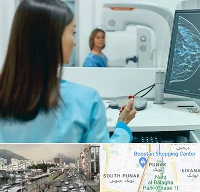 ماموگرافی در پونک 