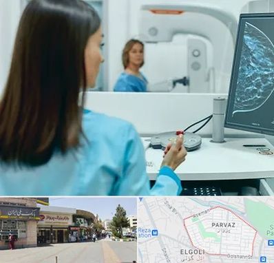 ماموگرافی در پرواز تبریز