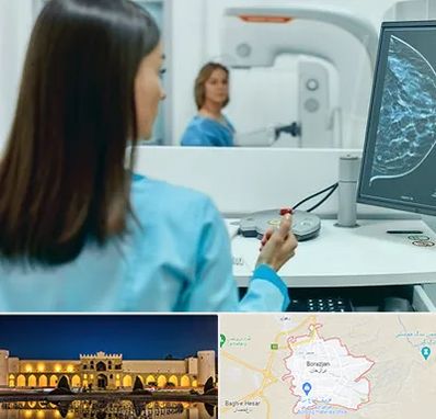 ماموگرافی در برازجان