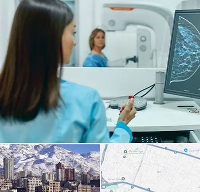 ماموگرافی در ازگل