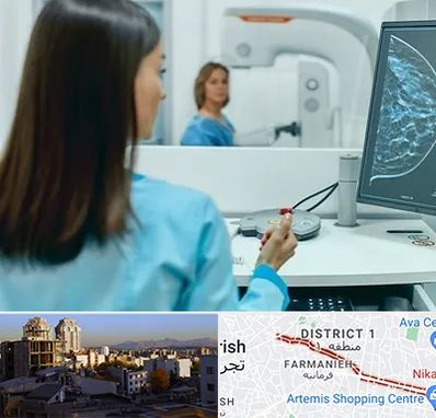 ماموگرافی در فرمانیه 