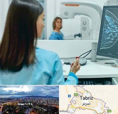 ماموگرافی در تبریز