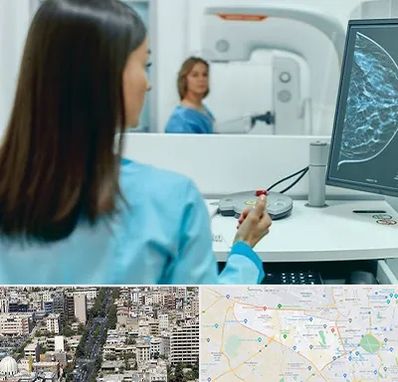 ماموگرافی در منطقه 18 تهران