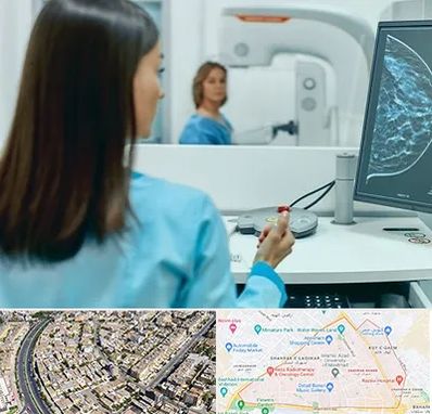 ماموگرافی در شهرک غرب مشهد