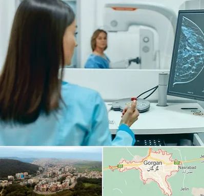 ماموگرافی در گرگان