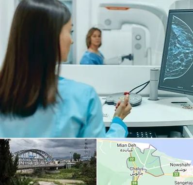 ماموگرافی در چالوس